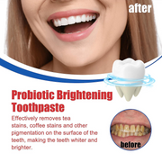 SP-6 Ultra Whitening Toothpaste (Original)
