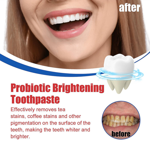 SP-6 Ultra Whitening Toothpaste (Original)