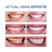 SP-6 Ultra Whitening Toothpaste (Original)