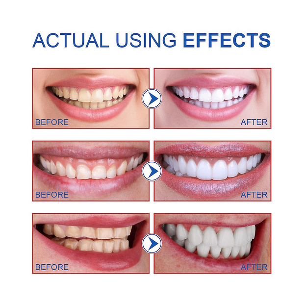 SP-6 Ultra Whitening Toothpaste (Original)