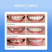 Snap On Smile Veneers Moldable False Artificial Braces Teeth Kits For Men And Women