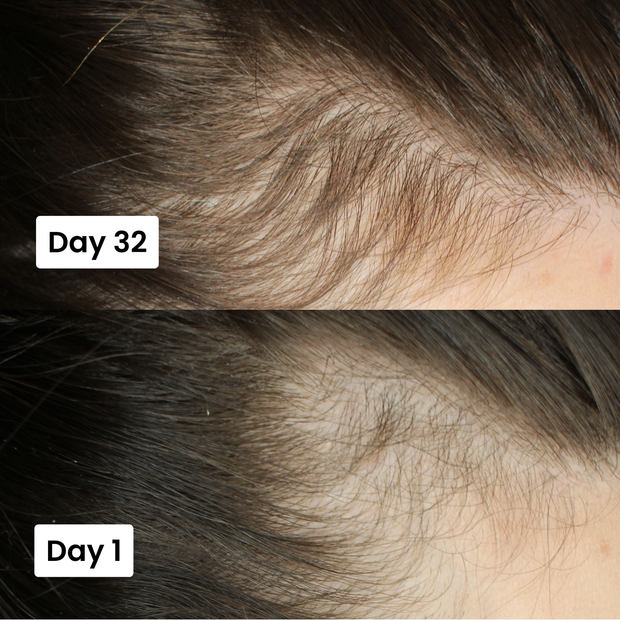 Scalp Hair Growth Serum