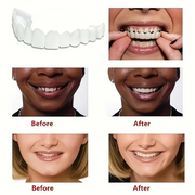 Snap On Smile Veneers Moldable False Artificial Braces Teeth Kits For Men And Women